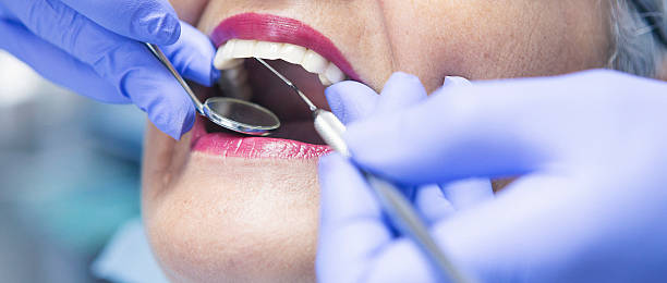 Best Dentist for Dental Trauma  in South Oroville, CA